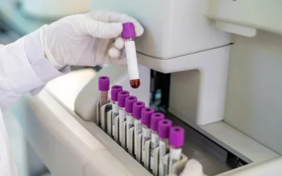 Colesterolul care ignora dieta ta. Avertismentul medicilor pentru toti romanii