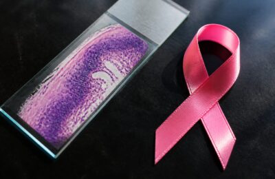 Cancerul de sân este diagnosticat de 25 de ori mai des decât cancerul de col uterin