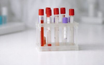 CNAS actualizează în 2026 consultațiile preventive și analizele decontate