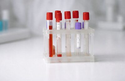 CNAS actualizează în 2026 consultațiile preventive și analizele decontate