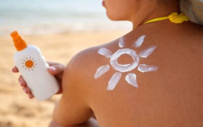Arsurile solare din tinerețe pot crește riscul de cancer la maturitate, explică medicul dermatolog
