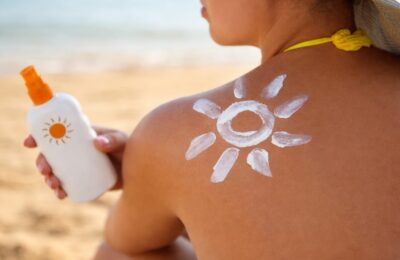 Arsurile solare din tinerețe pot crește riscul de cancer la maturitate, explică medicul dermatolog