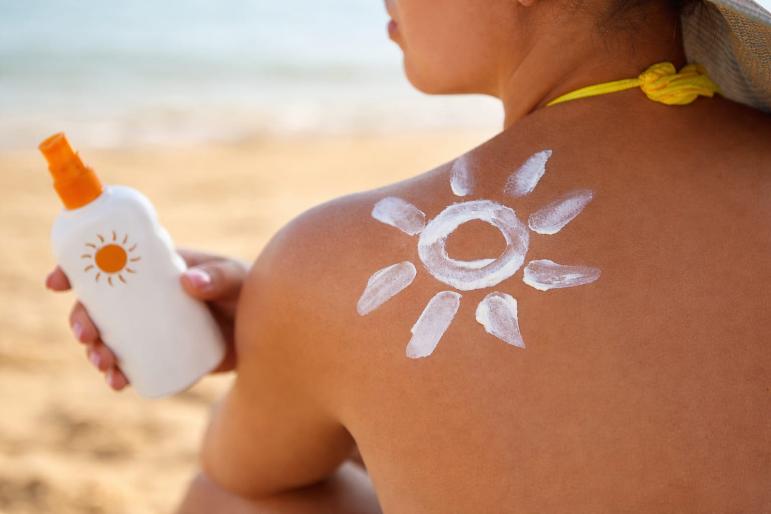 Arsurile solare din tinerețe pot crește riscul de cancer la maturitate, explică medicul dermatolog