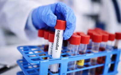 Focarul de Legionella din Elveția ne reamintește cum să ne protejăm familia de bacterie