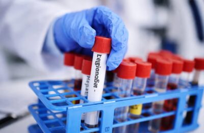 Focarul de Legionella din Elveția ne reamintește cum să ne protejăm familia de bacterie