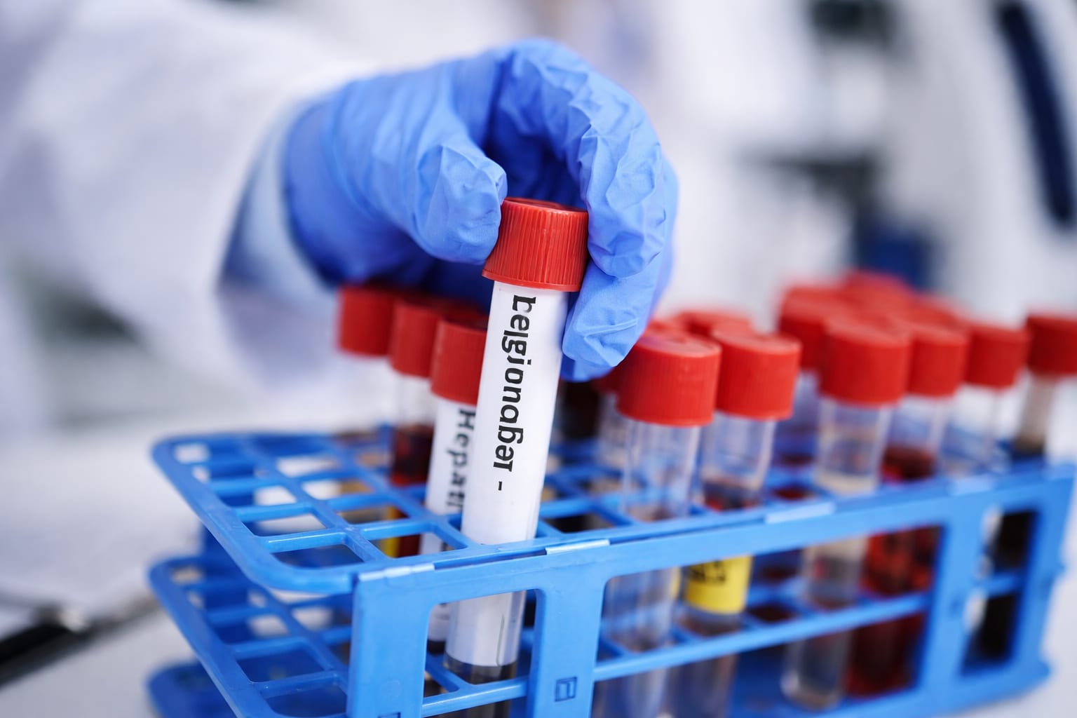Focarul de Legionella din Elveția ne reamintește cum să ne protejăm familia de bacterie
